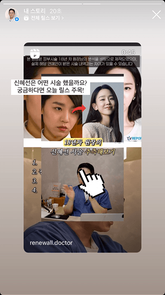 인스타그램 스토리 연동 사례 2
